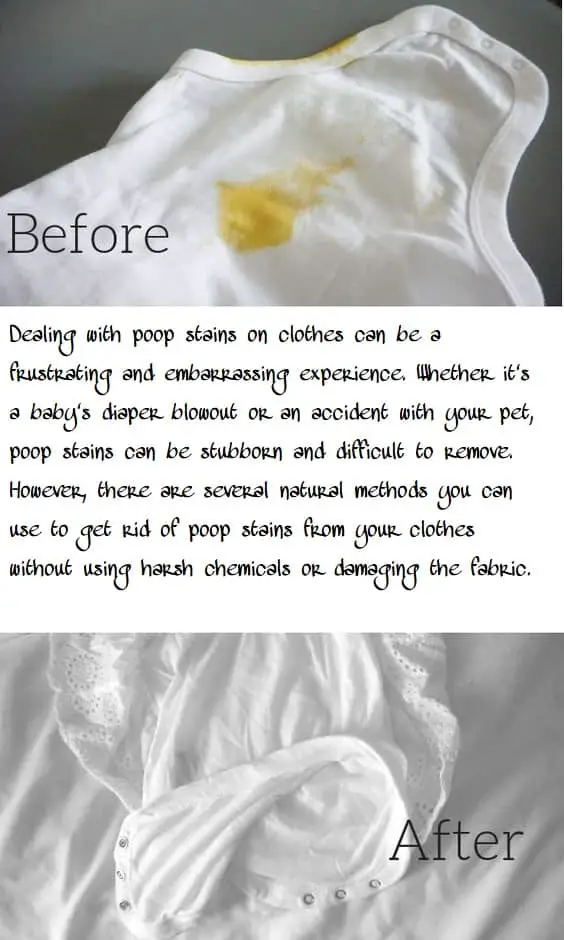 How To Remove Poop Stains From Clothes Naturally